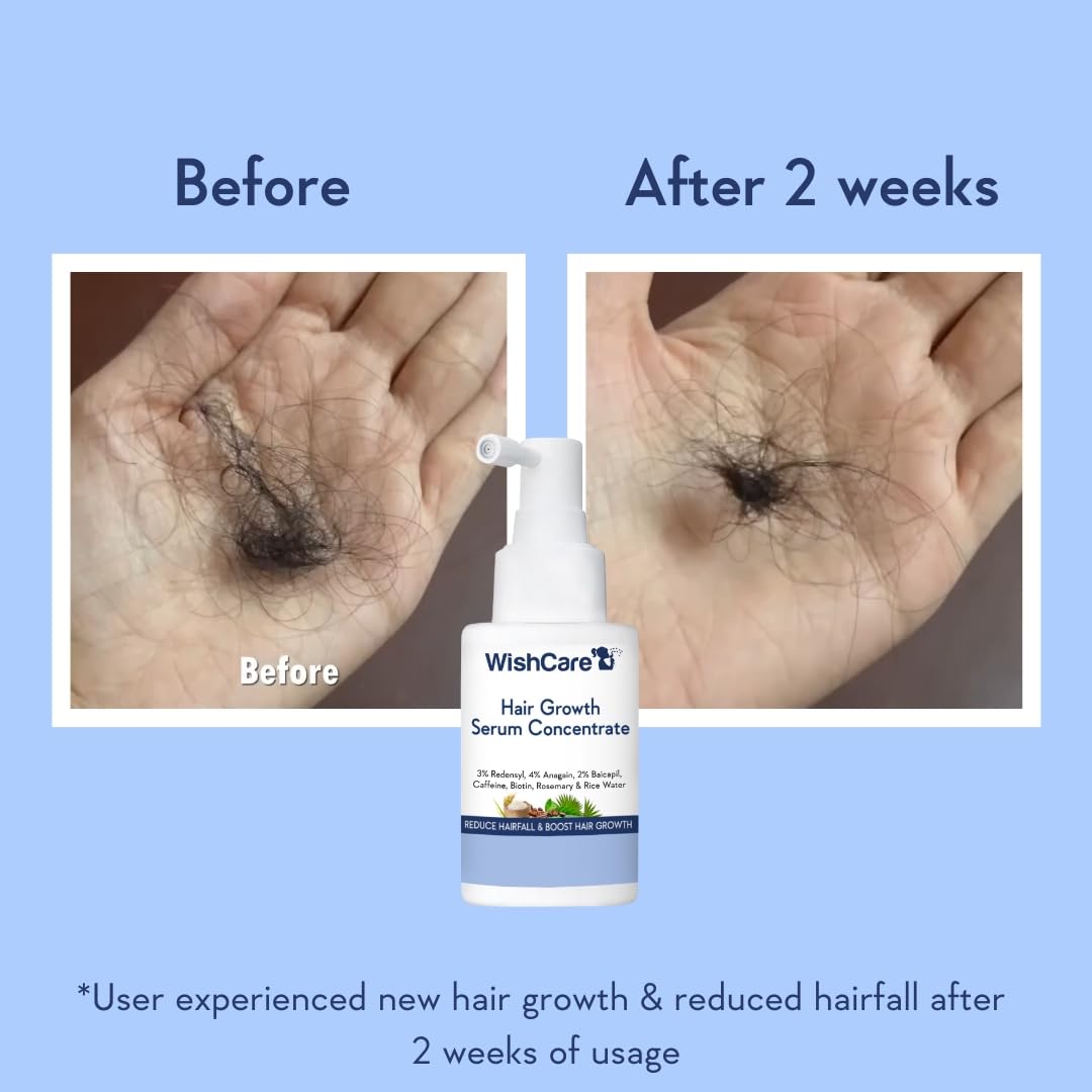 WishCare Hair Growth Serum Concentrate | Redensyl, Anagain & Rosemary | Boosts New Growth & Controls Hairfall | Hair Growth Serum for Scalp | In-Vivo Tested | For Men & Women | 30ml image 4