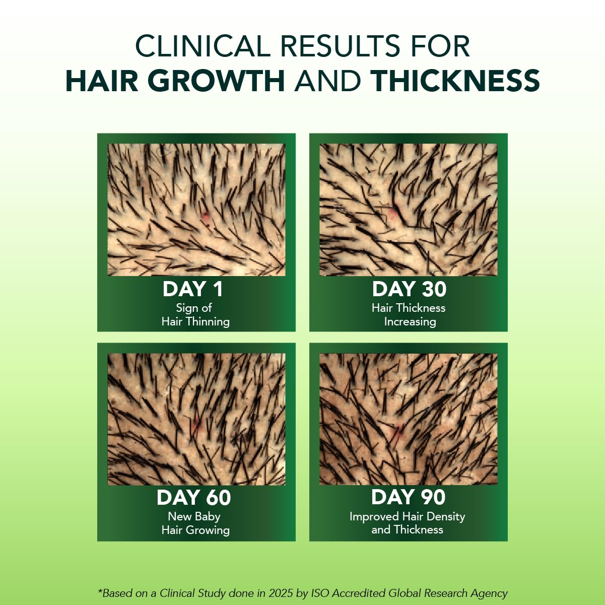 Alps Goodness Rosemary Water Spray for Hair Growth (250ml) | Clinically Proven (In Vivo Tested) to Reduce Hair Fall & Promote Regrowth | 100% Natural Rosemary Extract | Leave-On Scalp & Hair Spray For Men & Women image 4
