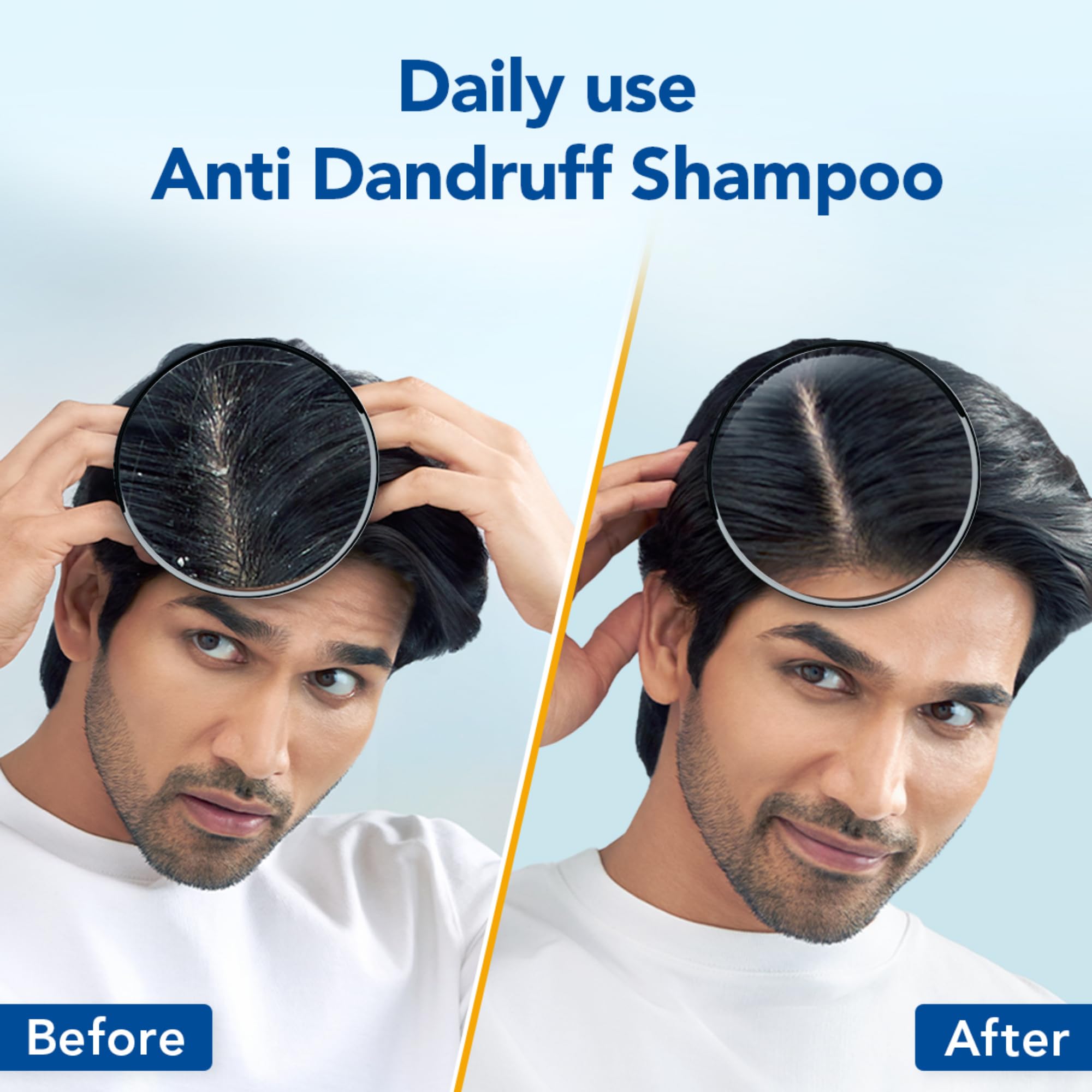 Scalpe Pro Daily Anti-Dandruff Shampoo | Removes Dandruff from Source | Prevents Itching & Irritation | Scalpe Science | Climbazole Formulation | Dermatologically Tested | For Women & Men | 200ml image 3