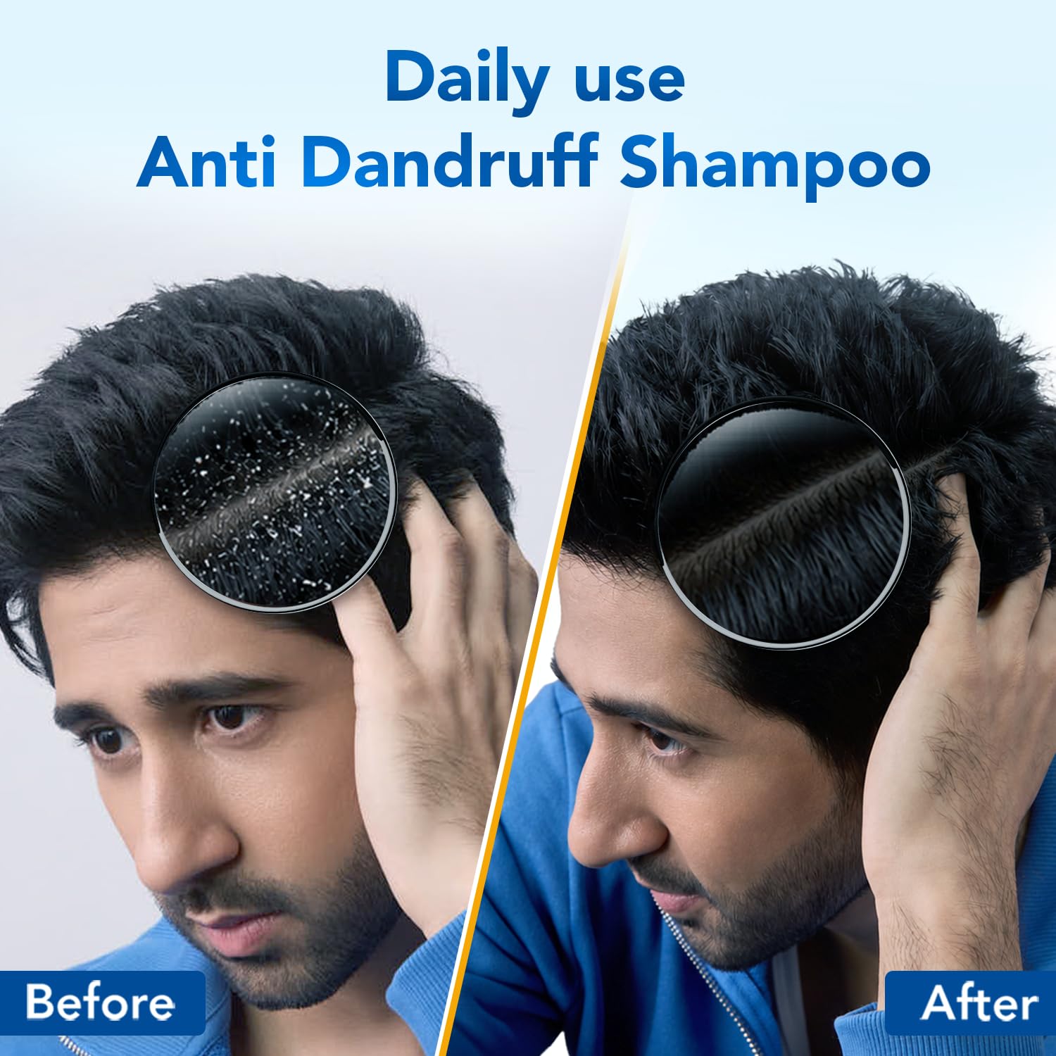 Scalpe Pro Daily Anti-Dandruff Shampoo | Removes Dandruff from Source | Prevents Itching & Irritation | Scalpe Science | Climbazole Formulation | Dermatologically Tested | For Women & Men | 100ml image 3