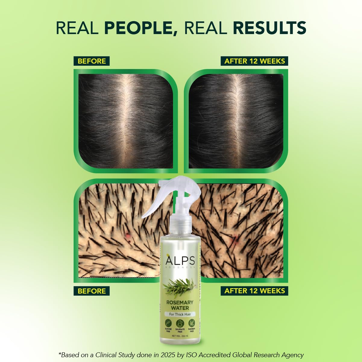 Alps Goodness Rosemary Water Spray for Hair Growth (250ml) | Clinically Proven (In Vivo Tested) to Reduce Hair Fall & Promote Regrowth | 100% Natural Rosemary Extract | Leave-On Scalp & Hair Spray For Men & Women image 3