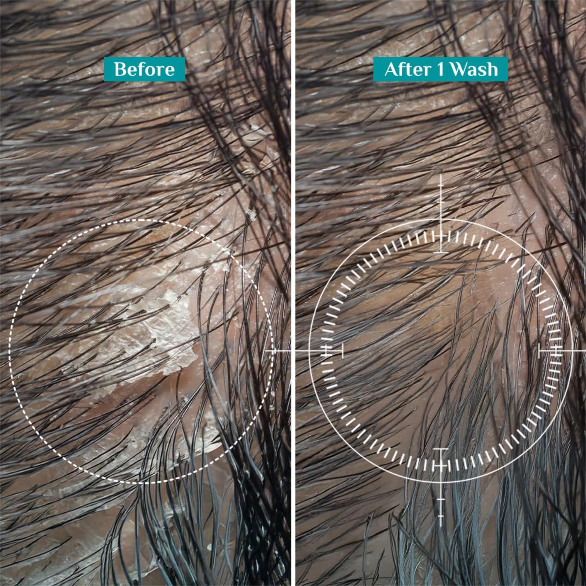 Pilgrim Australian Tea Tree Non-Drying Anti-Dandruff Shampoo 200 ml | Removes Dandruff from Source | Helps with Itching, Irritation | Strong & Smooth Hair | For Men & Women | image 5